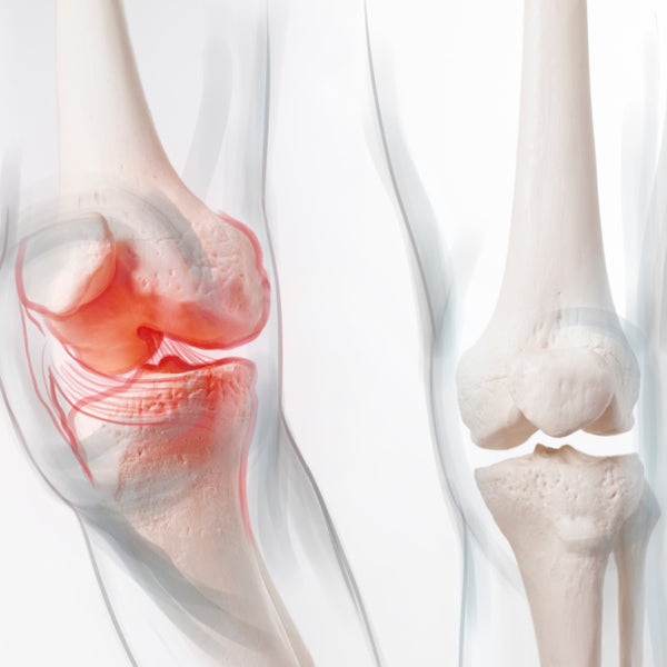 Strengthens the osteoarticular system