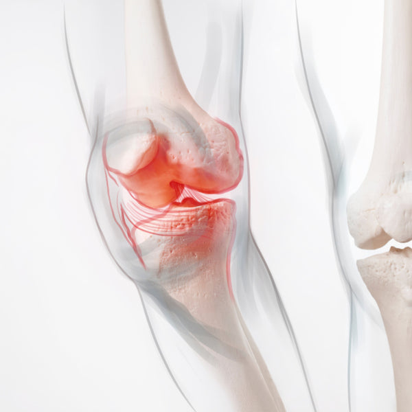 Reduce inflammation and support recovery